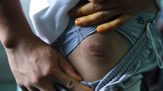 *Ryan (not his real name) has been in hiding for almost three years after he was shot in 2016 in Philippines President Rodrigo Duterte's war on drugs continues. Picture: Nicole Precel.