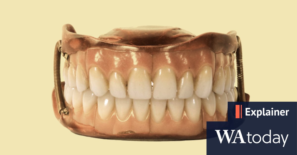 Dental health: What do our teeth tell us about our health? - Vimarsana News