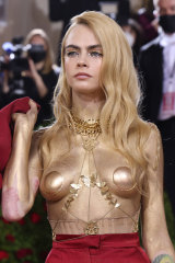Cara Delevigne chose not to cover her psoriasis at the 2022 Met Gala.   