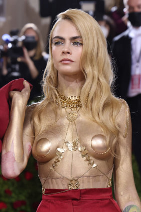 Cara Delevigne chose not to cover psoriasis at the 2022 Met Gala.   
