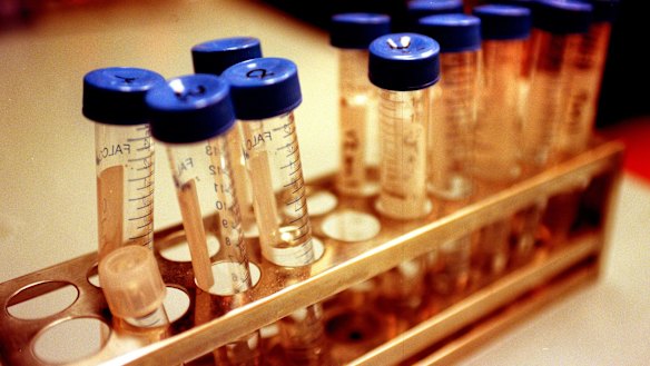 A new tool will help Australian couples considering IVF treatment calculate the chance of success.