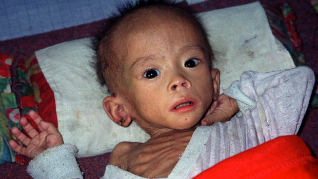 A starving North Korean child in 2002.