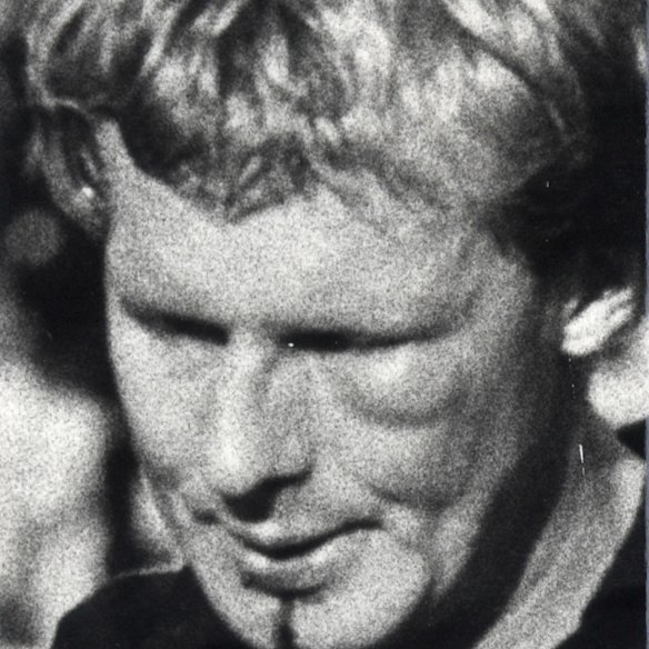Essendon’s Alan Stoneham, his left cheek swollen, leaves Princes Park at half-time against Hawthorn in 1983.