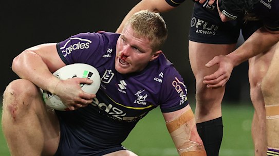 Josh King plays on as blood runs from his nose in the NRL preliminary final.