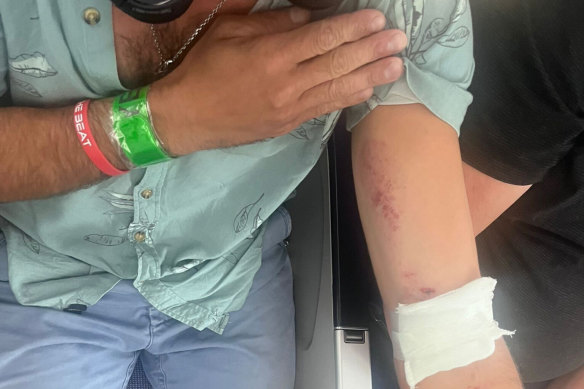 One of the injured passengers on the LATAM flight.