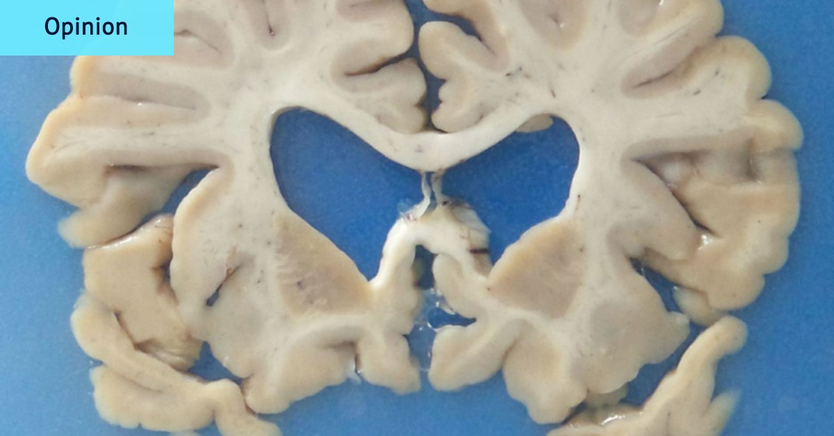 The data on contact sport, concussion and CTE is convincing. But not conclusive