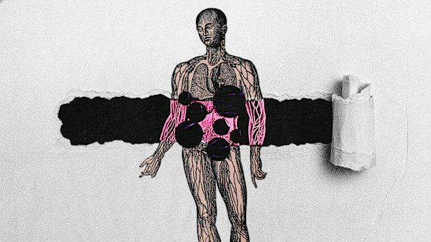 Some cancers are easier to diagnose than others. And some symptoms are like a whisper, easily disregarded by health professionals.