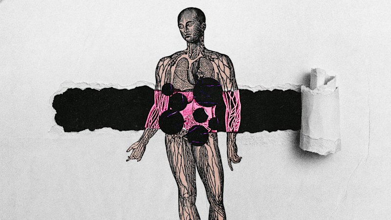 These cancers are so quiet, they are often caught too late. And they’re on the rise