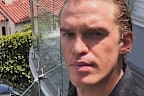 Cody Simpson health update