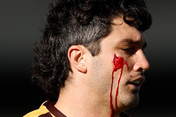 Tom Barrass of the Hawks leaves the field under the blood rule.