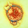 Hendra virus spilled into humans and horses from fruit bats.
