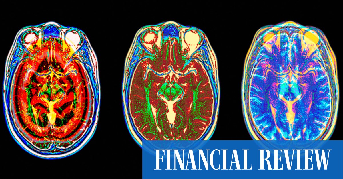 Book review: The Balanced Brain by Camilla Nord - Vimarsana News
