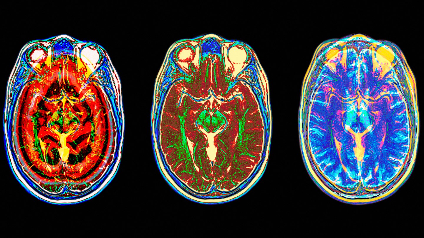 Book review: The Balanced Brain by Camilla Nord