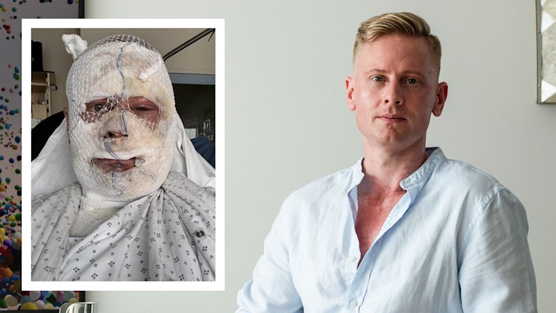 Callum Forbes went to sleep in a French chateau. He woke up in terror