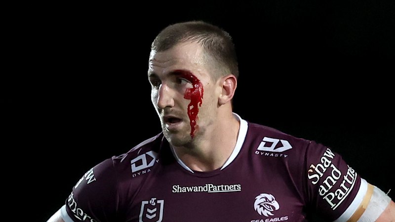 ‘Seasick for six weeks’: Croker’s concussion battle ends in medical retirement