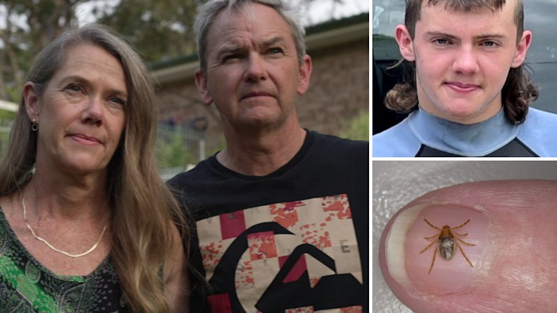 Jeremy, 16, died from a tick-induced meat allergy. Sydney’s north is a global hotspot for the disease