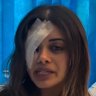 Hannah Thomas is in Bankstown Hospital with a serious eye injury requiring surgery after she was arrested with four others at a pro-Palestine protest in Sydney’s south-west.