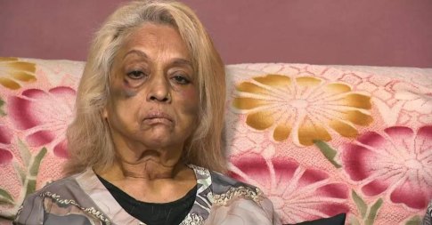 Home invasion victim Ninette Simons says: “I handed over all of my life’s savings on a platter, only to be bashed for it.”