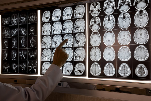 Westmead Hospital has a backlog of up to 3000 unreported MRI and other imaging scans.