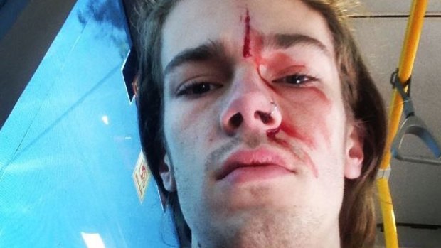 Sean Foster, the godson of Kevin Rudd, claims he was attacked while trying to stop another man removing rainbow posters in Brisbane.
