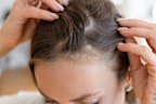 There are many common causes of hair shedding.