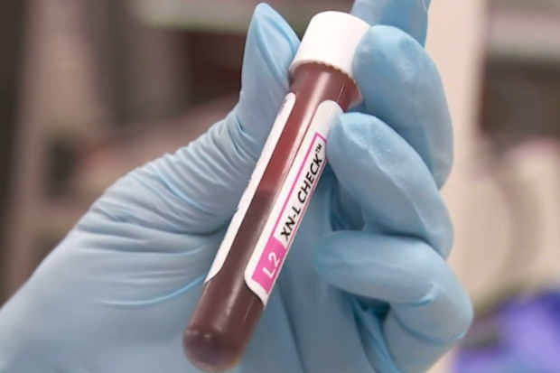 Australians with rare blood types are being given new hope thanks to Brisbane researchers who have grown blood in a lab.