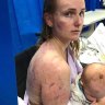 Mum, baby pelted by hailstones while caught in storm on Qld highway
