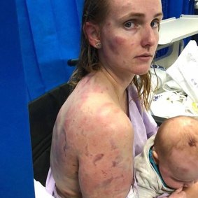 Kingaroy mother Fiona Simpson shielded her daughter as they were hammered by hail.