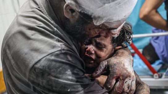 An injured child in Al-Aqsa hospital.  