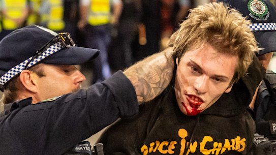 A protester with a bloodied mouth after being arrested.