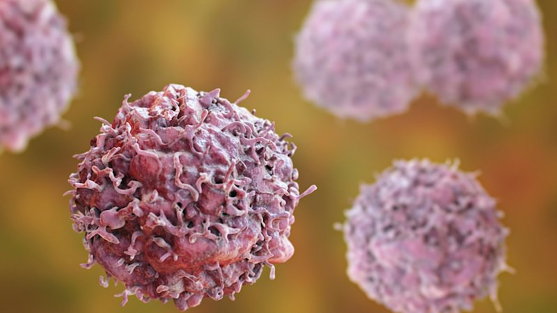 Fresh data backs Amplia push against pancreatic, ovarian cancer (australia) — SMH