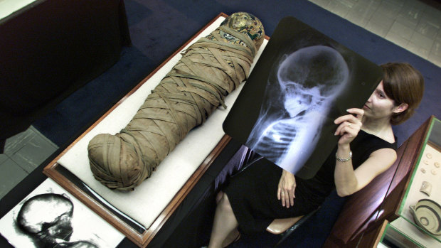 Mummified body parts to be removed from Sydney museum amid intense global debate