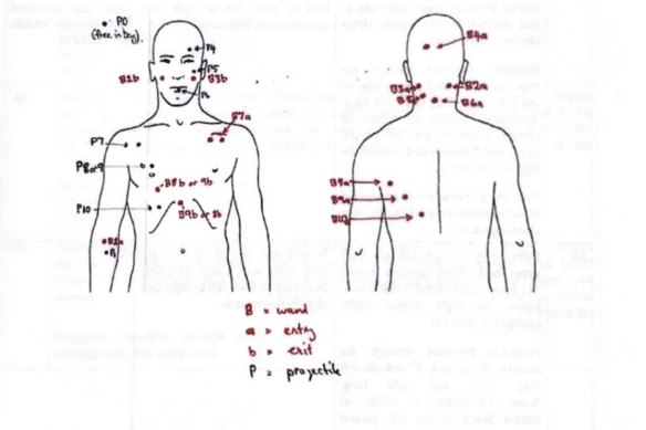 Police diagram of Pasquale Barbaro’s bullet wounds. The Italian organised crime figure was gunned down in 2016 by Abuzar Sultani’s crew. 