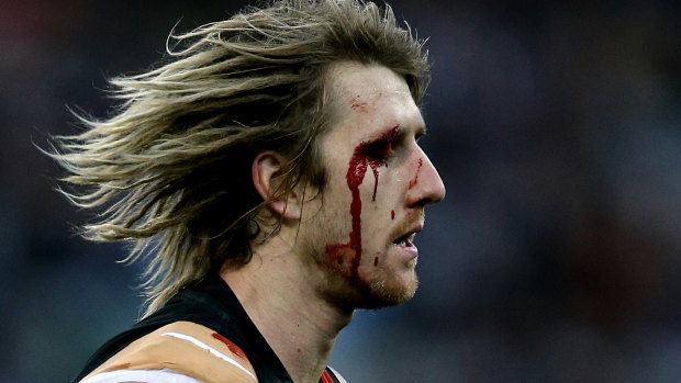 Bloodied but unbowed: Dyson Heppell received treatment for his cut eye and returned to the game for the Bombers.
