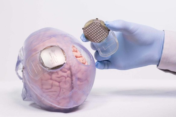 Two wireless brain implants help the system learn when the patient is trying to move their limbs.