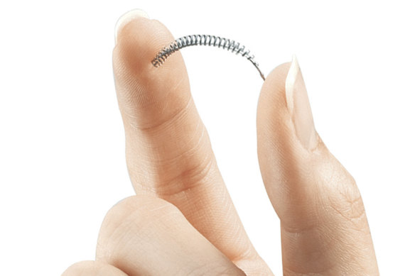 A key issue emerging in the case is whether the Essure device caused long-term inflammation.