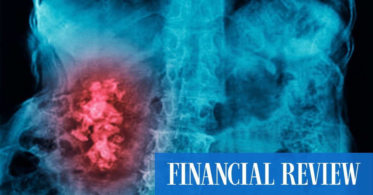 afr.com - Sarah Thompson, Kanika Sood, Angira Bharadwaj - Veteran stock picker Hugh Robertson bets on Melbourne's Akeeko Medical