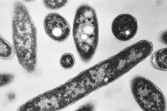 The Legionnaires’ bacterium.