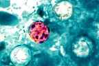 A microscopic image of the cyclospora parasite.