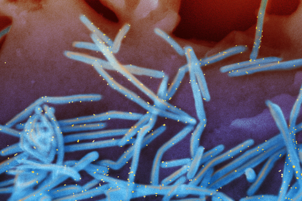 Electron micrograph of human RSV virions, depicted in blue. 