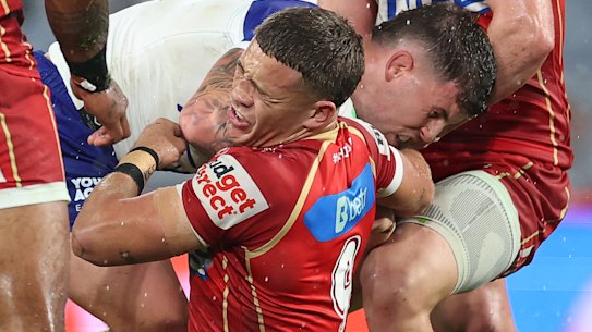 Kurt Donoghoe suffered a severely broken nose in the Dolphins’ win against the Bulldogs.