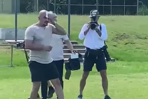 The member of the press pack was left with a bloodied forehead.