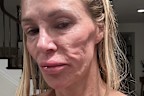 Glanville says she believes doctors will find a parasite in her face during an upcoming surgery.