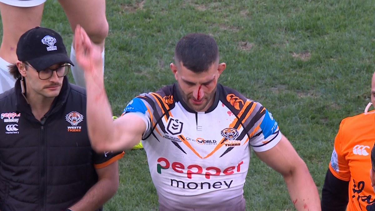 ‘Innocuous’ tackle leads to star’s fury in 45-second exit