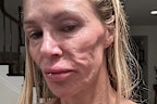 Glanville claimed she saw 21 doctors about her facial disfigurement before she was given the correct diagnosis. 