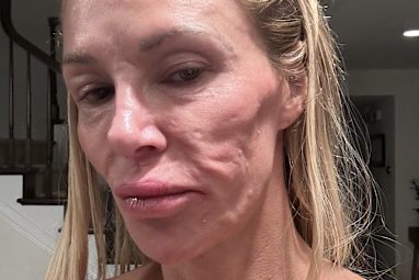 Glanville claimed she saw 21 doctors about her facial disfigurement before she was given the correct diagnosis. 
