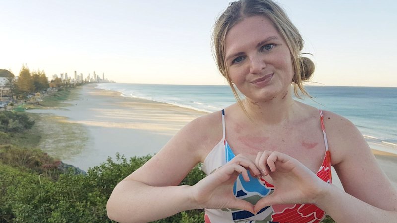 Caitlin nearly died from golden staph. New research is turning treatment on its head