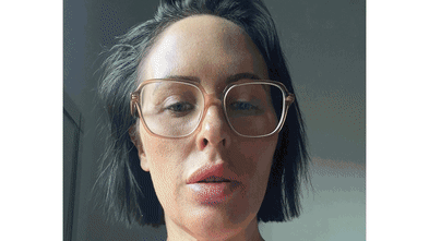 Gory “snatched” social media trend drives increased cosmetic tourism, doctors seek data