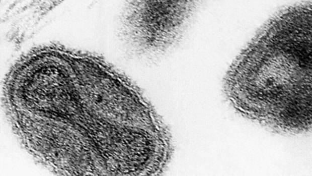 The smallpox virus is shown in this 1975 electronmicrograph from the US Centres for Disease Control.