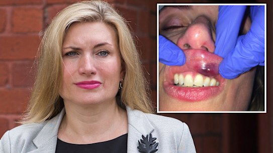 Dr Kim Proudlove claims she was assaulted by police in Melbourne's CBD.